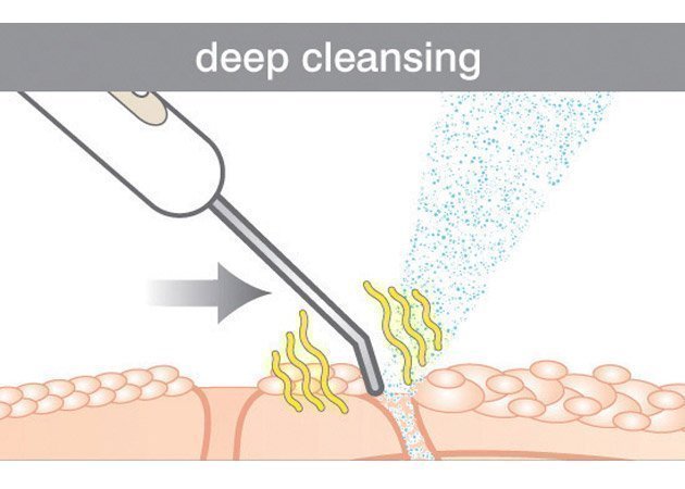 RIO Ultrasonic facial FASS2 Ultrazvuková špachtle violet