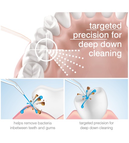 RIO Water Jet Flosser & oral irrigator